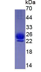 Figure . SDS-PAGE