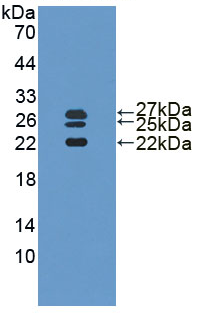 Figure . Western Blot; Sample: Recombinant IL1RA, Human; Antibody: Rabbit Anti-Human IL1RA Ab (PAA223Hu06)