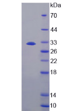 Figure . SDS-PAGE