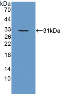 Figure . Western Blot
