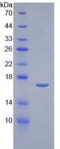 Figure . SDS-PAGE
