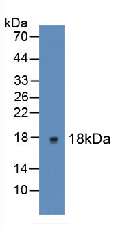 Figure . Western Blot