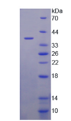 Figure . SDS-PAGE