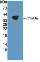 Figure . Western Blot