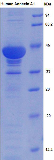 Figure . SDS-PAGE