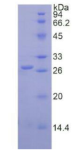 Figure . SDS-PAGE