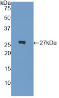Figure . Western Blot