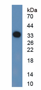 Figure . Western Blot