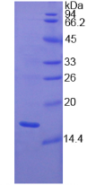 Figure . SDS-PAGE