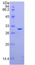 Figure . SDS-PAGE
