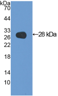 Figure . Western Blot