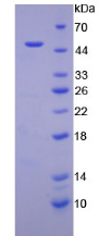 Figure . SDS-PAGE