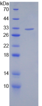 Figure . SDS-PAGE