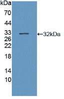 Figure . Western Blot