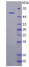 Figure . SDS-PAGE