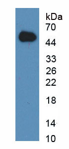 Figure . Western Blot