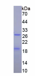 Figure . SDS-PAGE