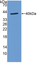 Figure . Western Blot