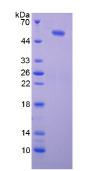 Figure . SDS-PAGE