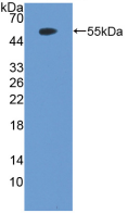 Figure . Western Blot