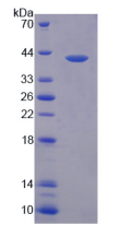 Figure . SDS-PAGE