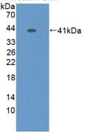 Figure . Western Blot