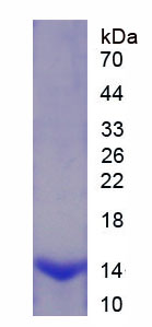 Figure . SDS-PAGE