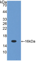 Figure . Western Blot