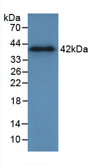 Figure . Western Blot