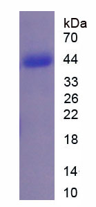 Figure . SDS-PAGE
