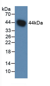 Figure . Western Blot