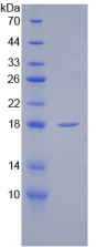Figure . SDS-PAGE
