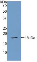 Figure . Western Blot
