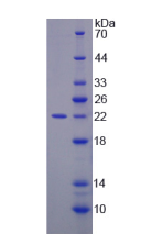 Figure . SDS-PAGE