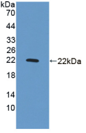 Figure . Western Blot