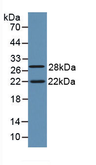 Figure . Western Blot