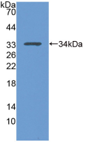 Figure . Western Blot