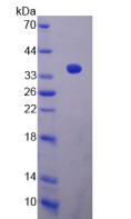Figure . SDS-PAGE