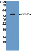 Figure . Western Blot