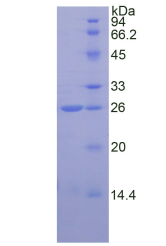 Figure . SDS-PAGE