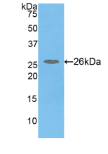 Figure . Western Blot