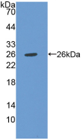 Figure . Western Blot