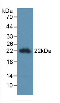 Figure . Western Blot