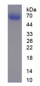 Figure . SDS-PAGE