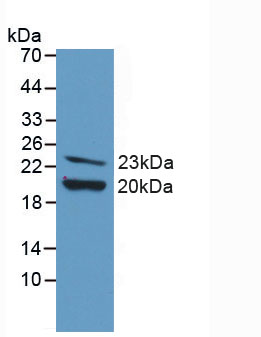 Figure . Western Blot