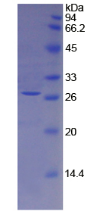 Figure . SDS-PAGE