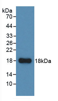 Figure . Western Blot