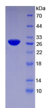 Figure . SDS-PAGE