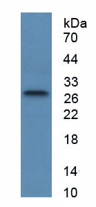 Figure . Western Blot
