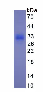 Figure . SDS-PAGE